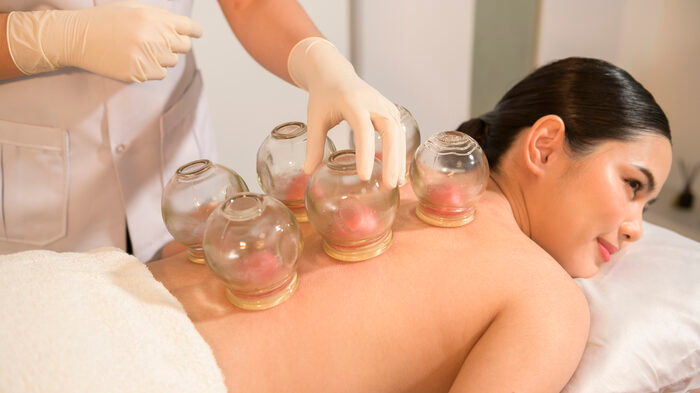 cupping therapy 1434